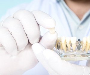 dentist holding a model of a mouth with dental implants